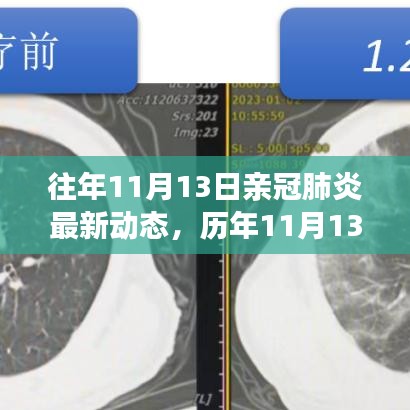 歷年11月13日新冠肺炎動態(tài)回顧，最新進展、當前動態(tài)與未來展望