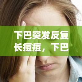 下巴突發(fā)反復(fù)長(zhǎng)痘痘，下巴突發(fā)性長(zhǎng)痘 