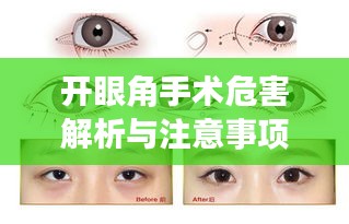 開眼角手術(shù)危害解析與注意事項(xiàng)指南——百度健康知識(shí)分享